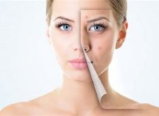 Making Skin Care Work For You Once And For All